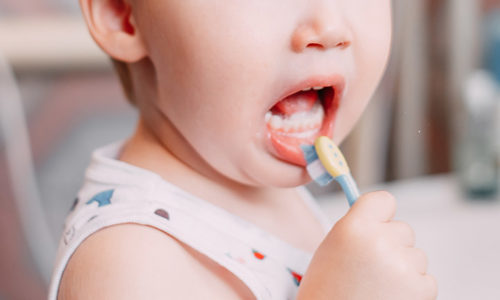 Răng sữa bị sâu có nên trám không. Trám răng sữa có lợi ích gì? Quy trình diễn ra như thế nào?